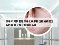 孩子12周岁老是脖子上有那样这样的癣是怎么回事 孩子脖子起癣怎么办