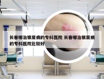 长春哪治银屑病的专科医院 长春哪治银屑病的专科医院比较好