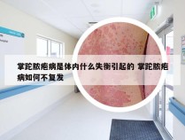 掌跎脓疱病是体内什么失衡引起的 掌跎脓疱病如何不复发