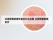 点滴型银屑病不能吃什么水果 点滴型银屑病食疗