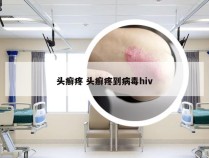 头癣疼 头癣疼到病毒hiv