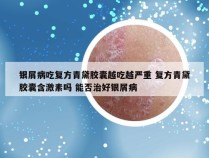 银屑病吃复方青黛胶囊越吃越严重 复方青黛胶囊含激素吗 能否治好银屑病