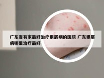 广东省有家最好治疗银屑病的医院 广东银屑病哪里治疗最好