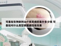 可善挺生物制剂治疗银屑病密集针多少钱 可善挺对什么类型银屑病没有效果