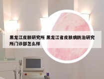 黑龙江皮肤研究所 黑龙江省皮肤病防治研究所门诊部怎么样