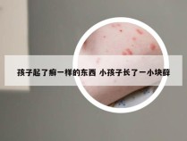 孩子起了癣一样的东西 小孩子长了一小块藓