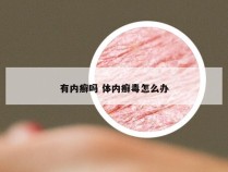 有内癣吗 体内癣毒怎么办