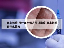 身上长癣,用什么小偏方可以治疗 身上长癣有什么偏方