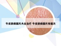 牛皮肤癣图片大全治疗 牛皮肤癣图片有偏方