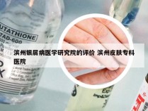 滨州银屑病医学研究院的评价 滨州皮肤专科医院