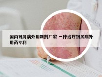 国内银屑病外用制剂厂家 一种治疗银屑病外用药专利