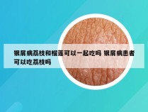 银屑病荔枝和榴莲可以一起吃吗 银屑病患者可以吃荔枝吗