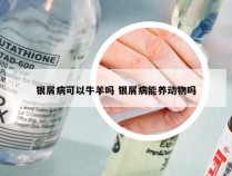 银屑病可以牛羊吗 银屑病能养动物吗