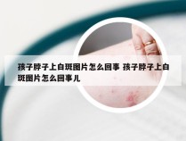 孩子脖子上白斑图片怎么回事 孩子脖子上白斑图片怎么回事儿