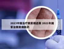 2023中国治疗银屑病进展 2021年国家治银屑病新药