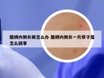 胳膊内侧长癣怎么办 胳膊内侧长一片疹子是怎么回事