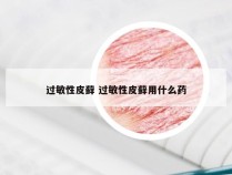 过敏性皮藓 过敏性皮藓用什么药