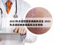 2023年点滴型银屑病最新消息 2023年点滴型银屑病最新消息视频