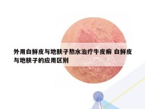 外用白鲜皮与地肤子熬水治疗牛皮癣 白鲜皮与地肤子的应用区别