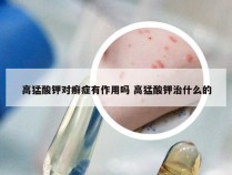 高猛酸钾对癣症有作用吗 高猛酸钾治什么的