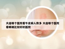 大连哪个医院看牛皮癣人数多 大连哪个医院看眼睛比较好的医院