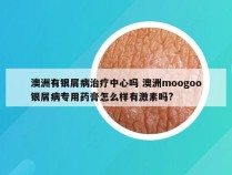 澳洲有银屑病治疗中心吗 澳洲moogoo银屑病专用药膏怎么样有激素吗?