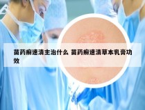 苗药癣速清主治什么 苗药癣速清草本乳膏功效