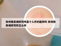 郑州银屑病研究所是个人开的医院吗 郑州银屑病研究院怎么样