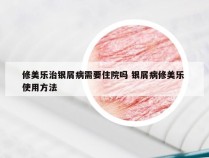 修美乐治银屑病需要住院吗 银屑病修美乐 使用方法