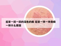 后背一团一团的深色的癣 后背一块一块像癣一样什么原因