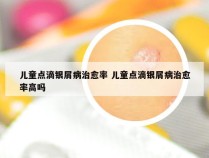 儿童点滴银屑病治愈率 儿童点滴银屑病治愈率高吗