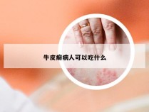 牛皮癣病人可以吃什么