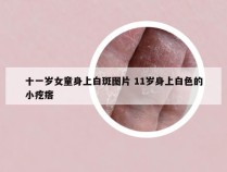 十一岁女童身上白斑图片 11岁身上白色的小疙瘩