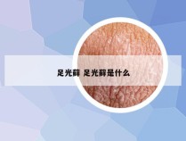 足光藓 足光藓是什么