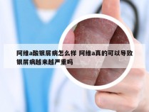 阿维a酸银屑病怎么样 阿维a真的可以导致银屑病越来越严重吗