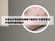 长春治疗掌跖脓疱病哪个医院好 长春哪家治疗跖疣的医院最好