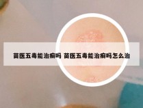 苗医五毒能治癣吗 苗医五毒能治癣吗怎么治