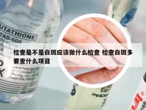 检查是不是白斑应该做什么检查 检查白斑多要查什么项目