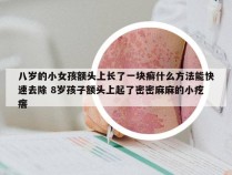 八岁的小女孩额头上长了一块癣什么方法能快速去除 8岁孩子额头上起了密密麻麻的小疙瘩