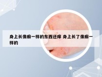 身上长像癣一样的东西还痒 身上长了像癣一样的