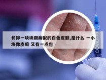 长得一块块跟癣似的白色皮肤,是什么 一小块像皮癣 又有一点包