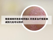 银屑病用环孢素和阿维A 环孢素治疗银屑病减到几粒可以停药