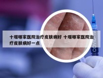 十堰哪家医院治疗皮肤病好 十堰哪家医院治疗皮肤病好一点