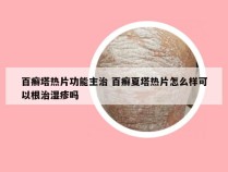 百癣塔热片功能主治 百癣夏塔热片怎么样可以根治湿疹吗