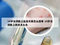 14岁女孩脸上起皮长癣怎么回事 14岁女孩脸上脱皮怎么办