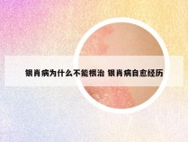 银肖病为什么不能根治 银肖病自愈经历