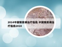 2014中国银屑病治疗指南 中国银屑病治疗指南2018