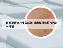 百癣夏塔热片多久起效 百癣夏塔热片几天为一疗程