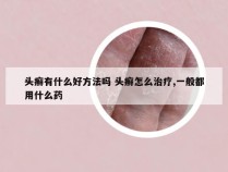 头癣有什么好方法吗 头癣怎么治疗,一般都用什么药