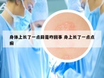 身体上长了一点藓是咋回事 身上长了一点点癣